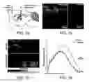 Fig. 12 - Optogenetic magnetic resonance imaging