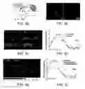 Fig. 13 - Optogenetic magnetic resonance imaging