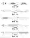 Fig. 04 - Methods for producing a semi-adiabatic spectral-spatial spectroscopic imaging sequence and devices thereof