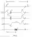 Fig. 03 - SYSTEM AND METHOD FOR MAGNETIC RESONANCE I MAGING WITH PROSPECTIVE MOTION CONTROL
