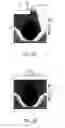 Fig. 03 - PHOTODETECTOR, AND CT DEVICE INCLUDING SAID PHOTODETECTOR