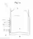 Fig. 02 - Augmented reality glasses for medical applications and corresponding augmented reality system