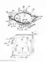 Fig. 03 - Integrated camera lens suspension