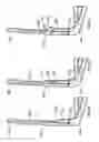 Fig. 06 - Eyewear retention devices and methods