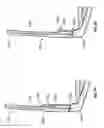 Fig. 07 - Eyewear retention devices and methods