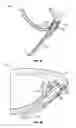 Fig. 10 - Eyewear retention devices and methods