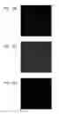 Fig. 13 - FOCUSING PLATE AND VIEWFINDER SYSTEM HAVING THE SAME