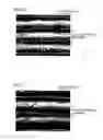 Fig. 13 - Semiconductive roller, and method of producing the same