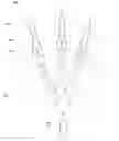 Fig. 01 - Resisting user movement using actuated tendons