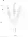 Fig. 04 - Resisting user movement using actuated tendons