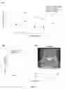Fig. 06 - Systems and methods for model-based optimization of spinal cord stimulation electrodes and devices