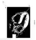 Fig. 04 - Systems and methods for identifying optimized ablation targets for treating and preventing arrhythmias sustained by reentrant circuits