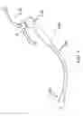 Fig. 06 - DEVICE FOR HEARING OWN VOICE
