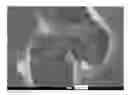 Fig. 01 - Electrode For Photovoltaic Cells And Associated Preparation Process