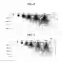 Fig. 03 - STRUCTURE ANALYSIS METHOD USING A SCANNING ELECTRON MICROSCOPE