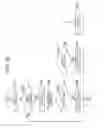 Fig. 43 - Imaging element, electronic device, and information processing device