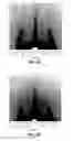 Fig. 20 - Metal chalcogenides for pseudocapacitive applications