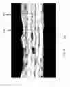 Fig. 08 - Layered Electrolytes and Modules for Solid Oxide Cells