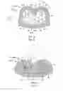 Fig. 03 - Crimp contact with improved contacting and crimp connection