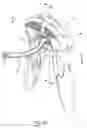 Fig. 03 - Cable assembly tool