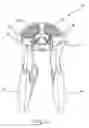 Fig. 04 - Cable assembly tool