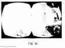 Fig. 08 - Stereo viewing