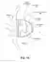 Fig. 12 - Microphone assembly having an acoustic leak path