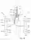 Fig. 07 - Endovascular apparatus for perfusing organs in a body