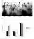 Fig. 05 - Seed-origin endophyte populations, compositions, and methods of use