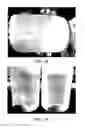 Fig. 03 - Food compositions comprising one or both of recombinant beta-lactoglobulin protein and recombinant alpha-lactalbumin protein