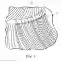 Fig. 02 - HAIR EXTENSION SYSTEM