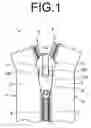Fig. 02 - Slider for slide fastener
