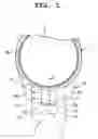 Fig. 02 - Band and timepiece
