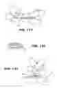 Fig. 22 - Packaging for disposable soft contact lenses