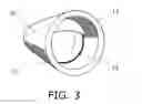 Fig. 03 - Nail Clipping Cylinder