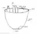 Fig. 12 - Portable easyP urinal