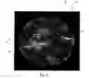 Fig. 07 - Pre-Moistened Fibrous Structures