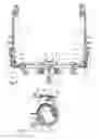 Fig. 06 - Trial Frame