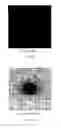 Fig. 08 - Automatic three-dimensional segmentation method for OCT and doppler OCT angiography