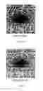 Fig. 09 - Automatic three-dimensional segmentation method for OCT and doppler OCT angiography