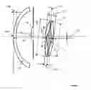 Fig. 02 - Method for the optimized prediction of the postoperative anatomical position of an intraocular lens implanted in a pseudophakic eye