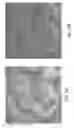 Fig. 06 - INTRAOPERATIVE GUIDANCE SYSTEM FOR TUMOR SURGERY