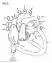 Fig. 03 - BLOOD PRESSURE SENSOR