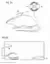 Fig. 06 - BLOOD PRESSURE SENSOR