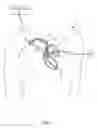 Fig. 02 - Implantable medical sensor and fixation system