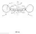 Fig. 03 - Implantable medical sensor and fixation system