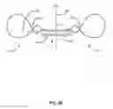 Fig. 04 - Implantable medical sensor and fixation system
