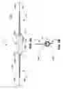 Fig. 05 - Implantable medical sensor and fixation system