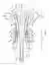 Fig. 12 - Catheter with multi-functional control handle having rotational mechanism