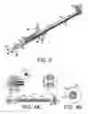 Fig. 03 - Neurotrophic electrode system
